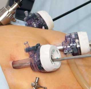 Gastrology Treatment in  Kochi
