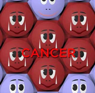 Cancer Treatment  in Ernakulam